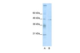 Antibody used in WB on Human HepG2 at 2.5 ug/ml.