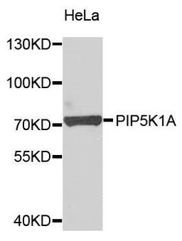 Western blot analysis of extracts of HeLa cells using PIP5K1A antibody