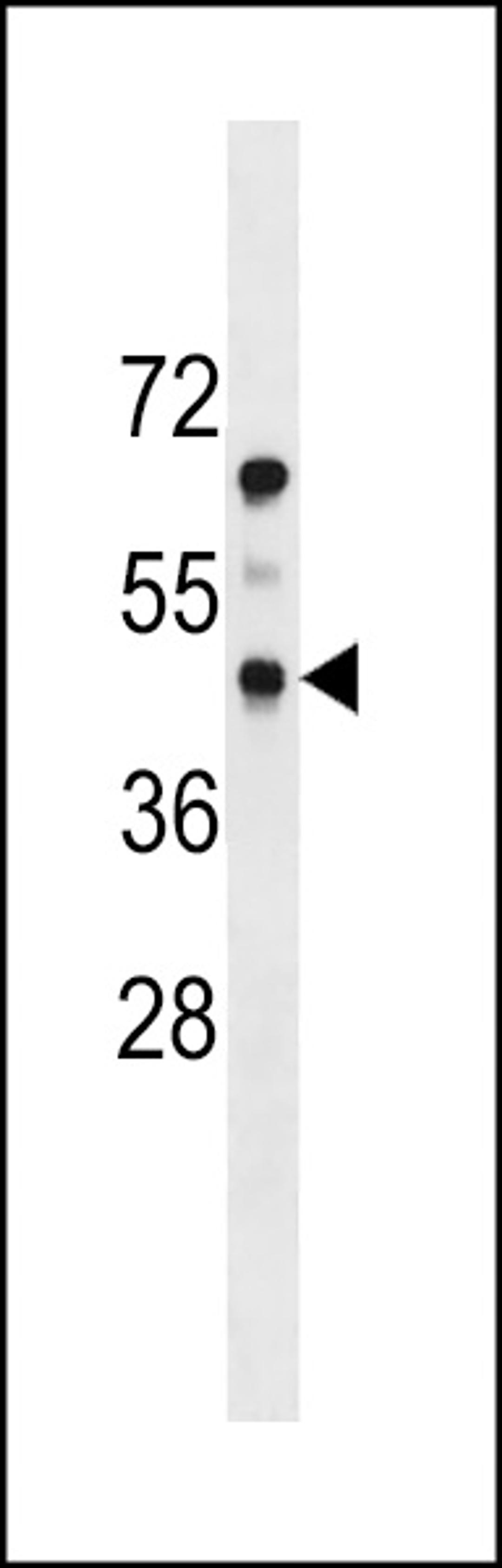 Western blot analysis in mouse heart tissue lysates (35ug/lane).