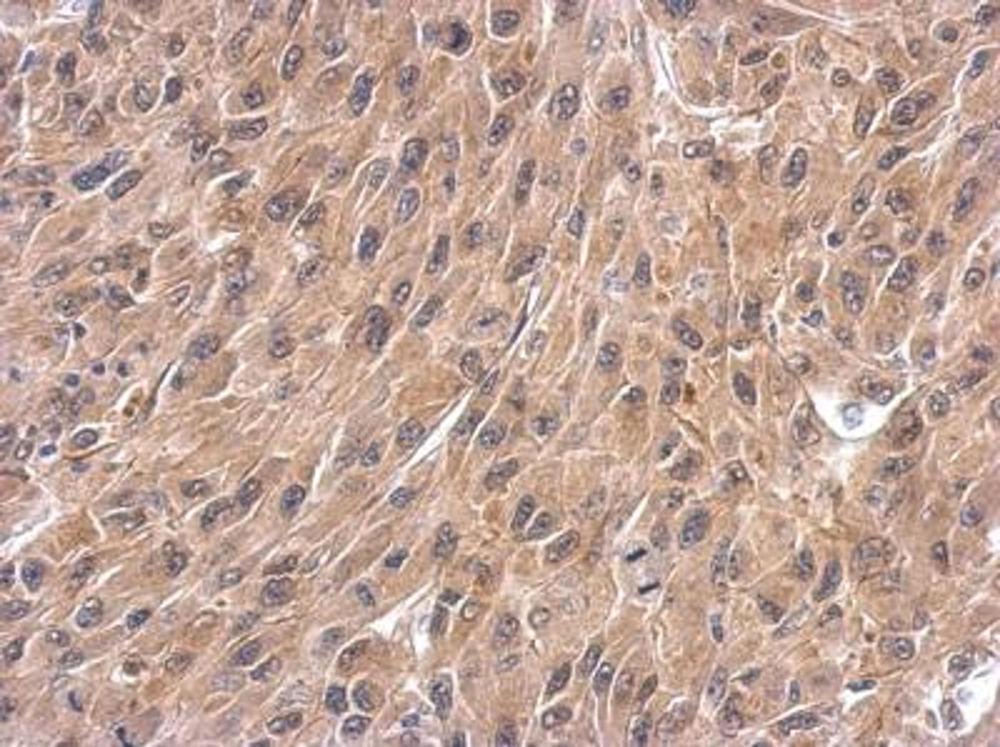 Immunohistochemistry-Paraffin: Wnt-4 Antibody [NBP2-20909] - Analysis of paraffin-embedded U87 xenograft.