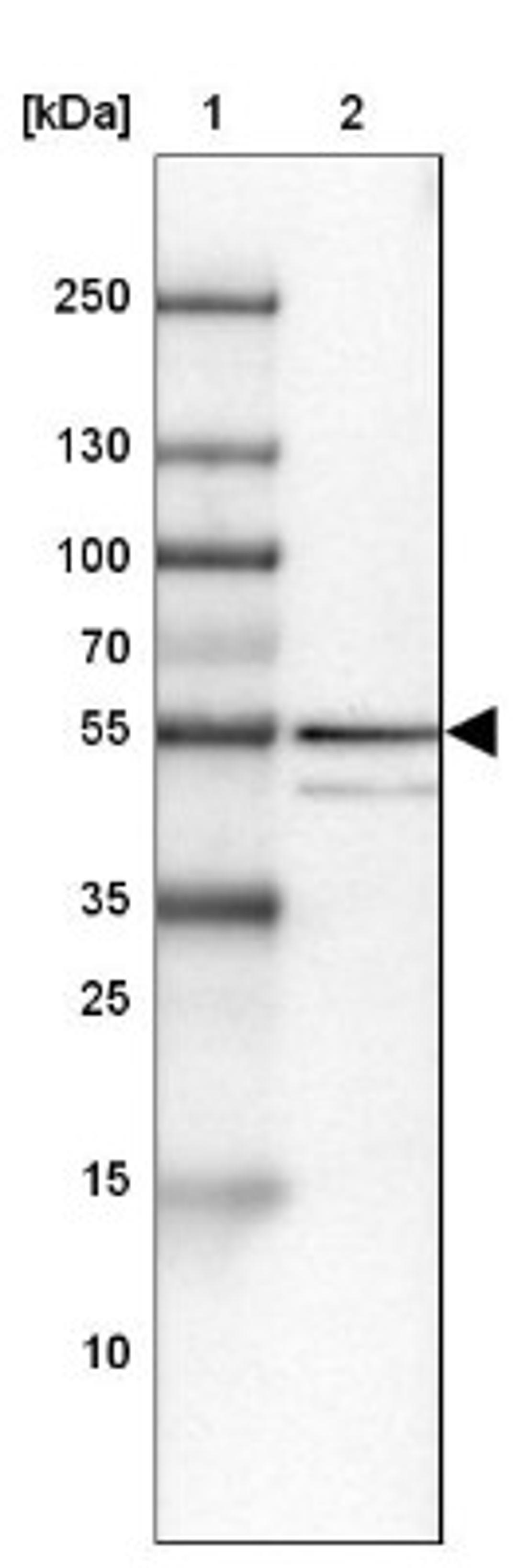 Western Blot: ZNF185 Antibody [NBP1-86452] - Lane 1: Marker [kDa] 250, 130, 100, 70, 55, 35, 25, 15, 10<br/>Lane 2: Liver