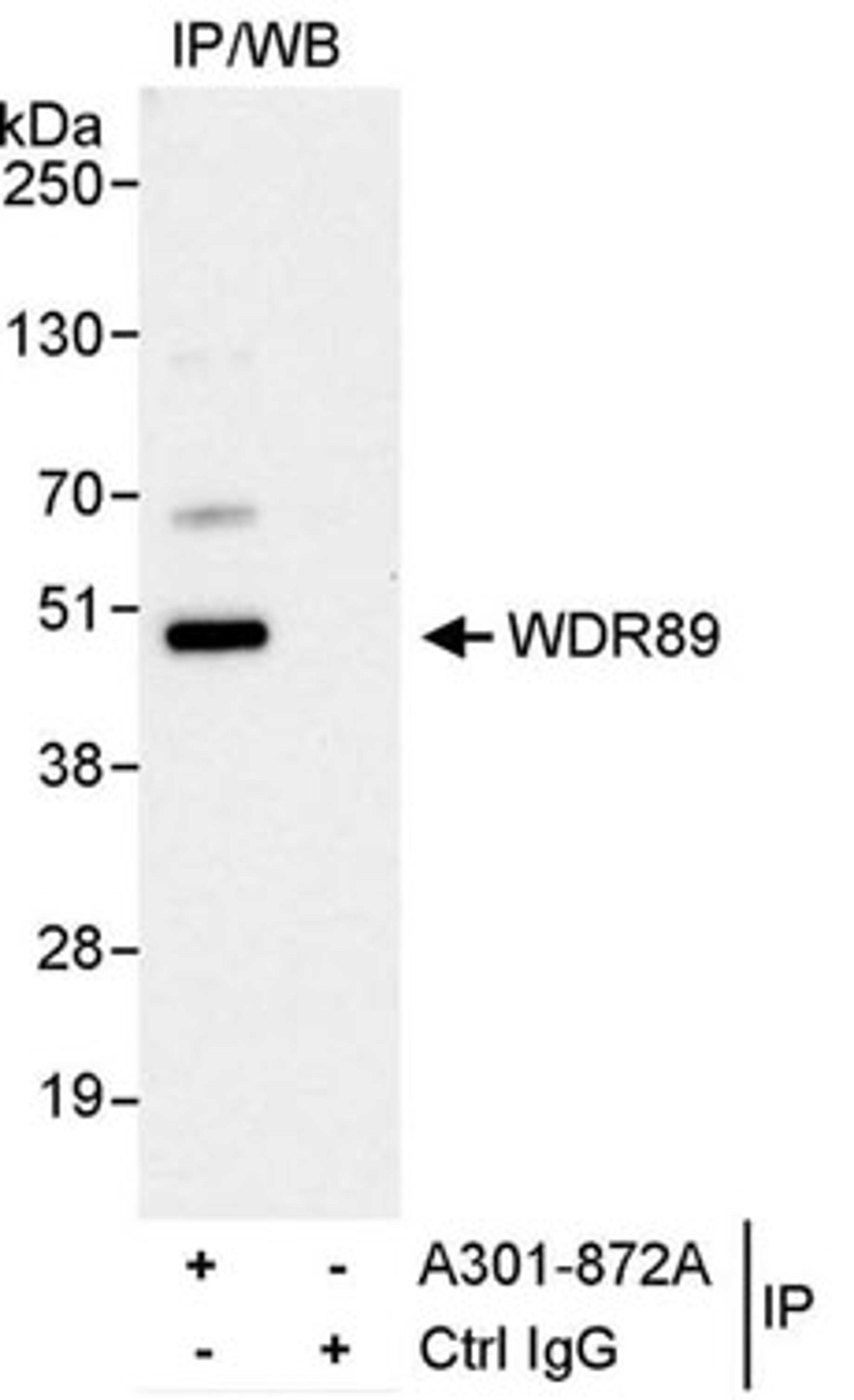 Detection of human WDR89 by western blot of immunoprecipitates.