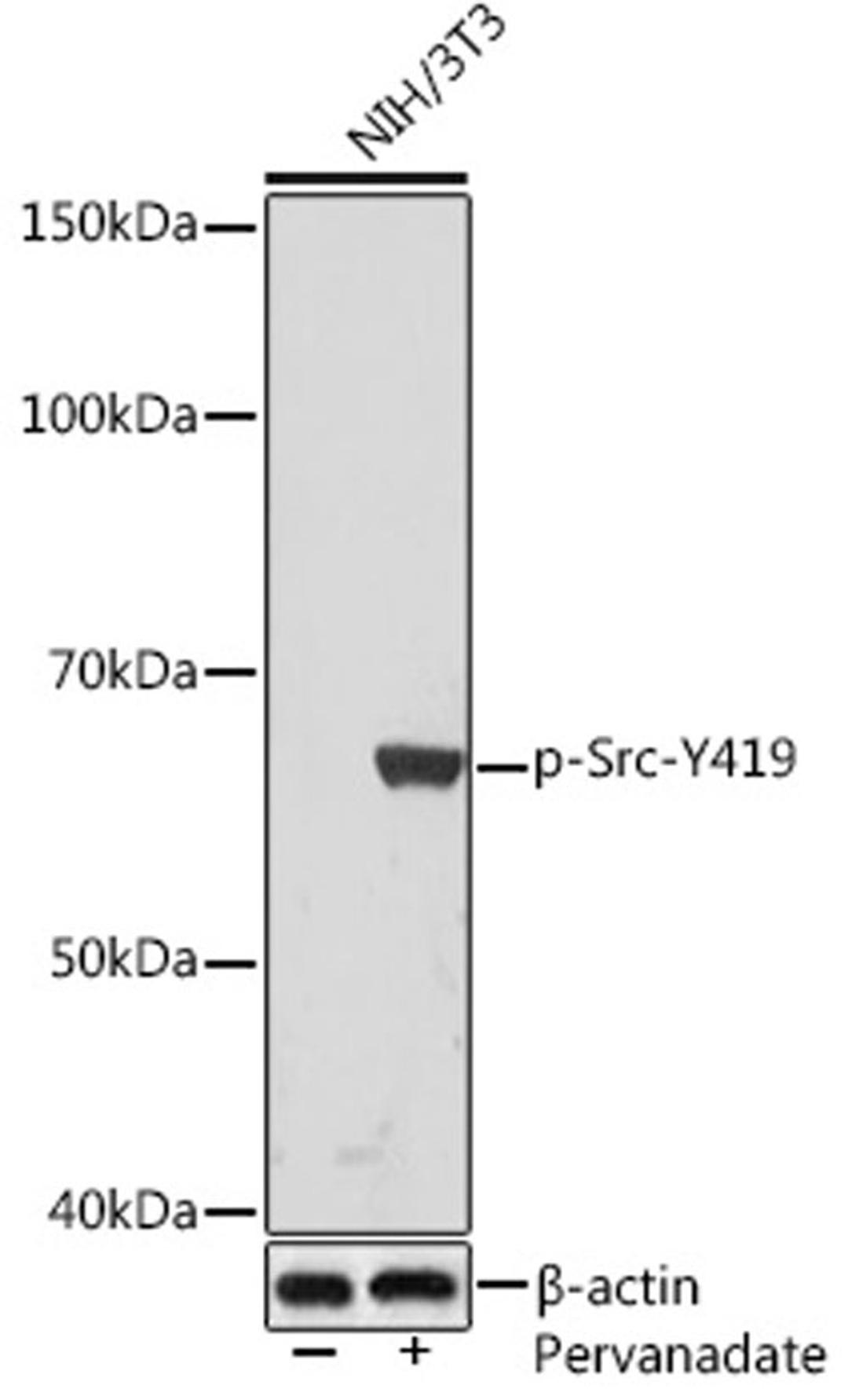 Western blot - Phospho-Src-Y419 Rabbit mAb (AP1027)