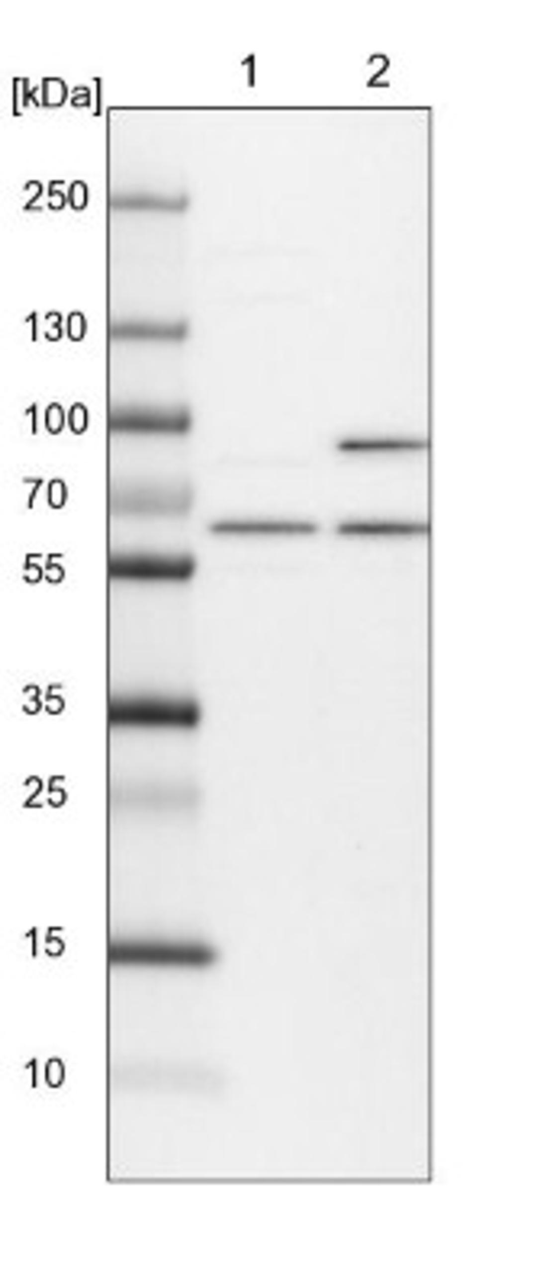 Western Blot: NEDD8 Activating Enzyme (APPBP1/UBA3) Antibody [NBP1-92163] - Lane 1: NIH-3T3 cell lysate (Mouse embryonic fibroblast cells)<br/>Lane 2: NBT-II cell lysate (Rat Wistar bladder tumour cells)