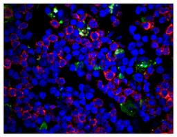 Frozen piglet thymus section was stained with Mouse Anti-Porcine CD3?-SPRD (Cat. No. 99-137) and anti-LC3 followed by a secondary antibody and DAPI.

Image from Wang G, Yu Y, Tu Y, Tong J, Liu Y, Zhang C, et al. Highly pathogenic porcine reproductive and 