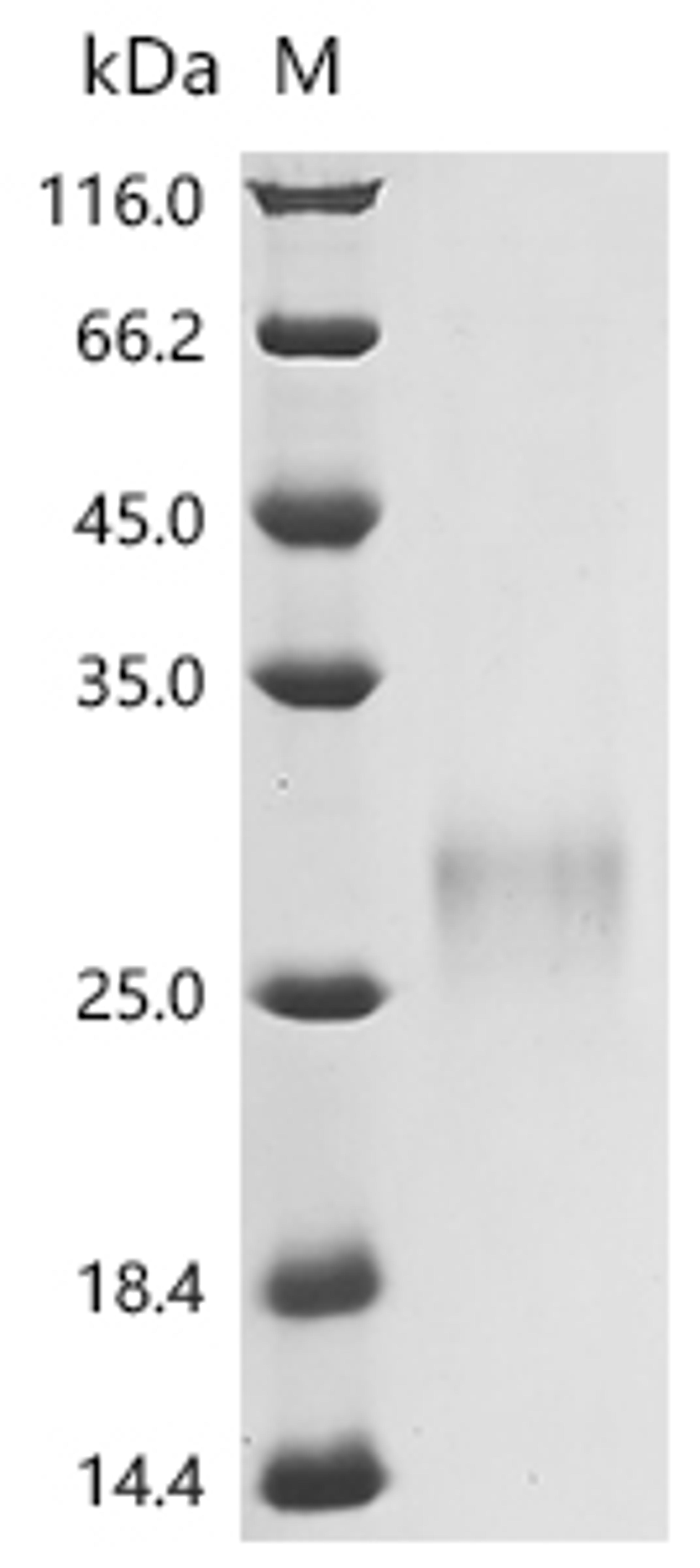 (Tris-Glycine gel) Discontinuous SDS-PAGE (reduced) with 5% enrichment gel and 15% separation gel.