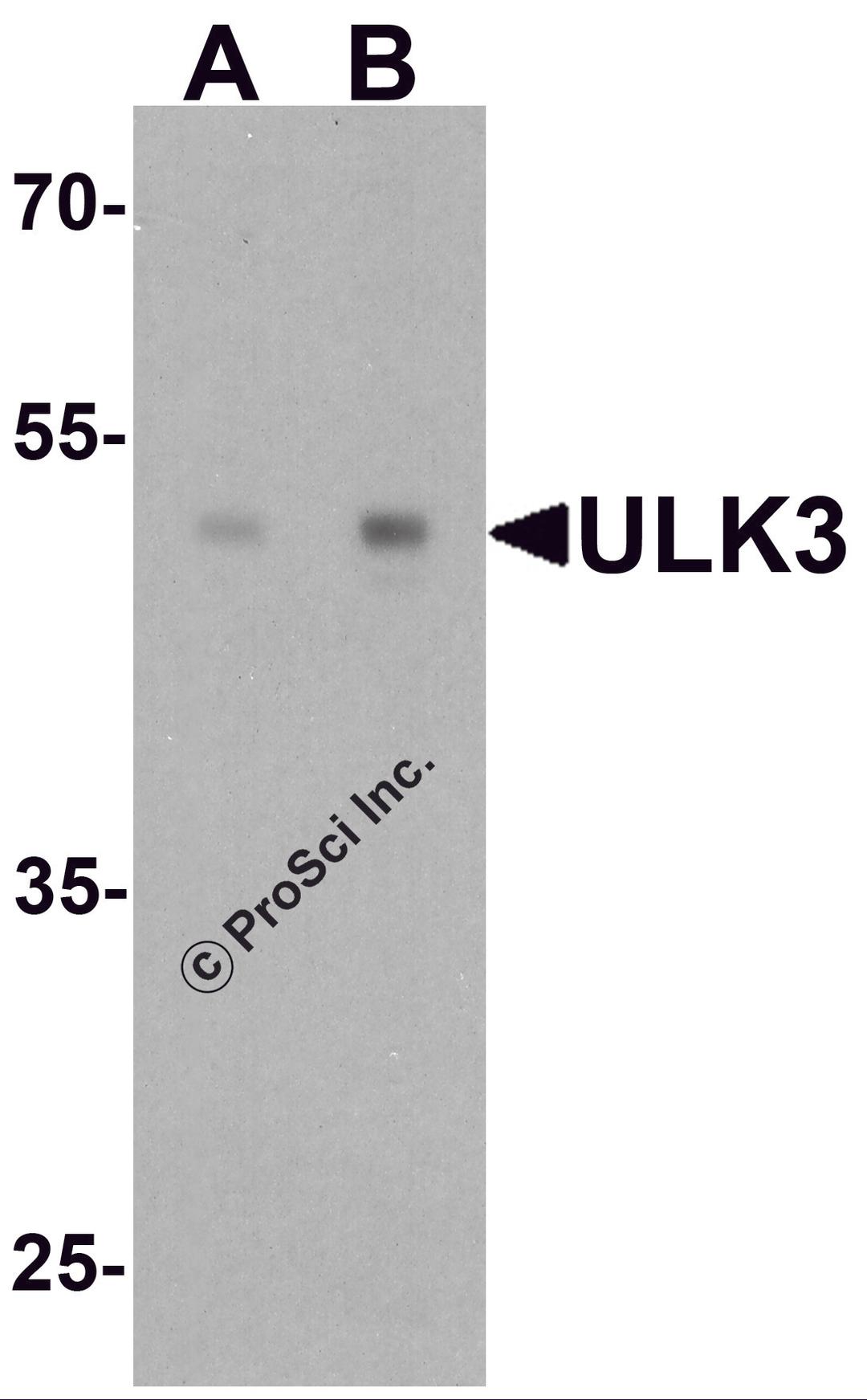 Western blot analysis of ULK3 in human brain tissue lysate with ULK3 antibody at (A) 0.5 and (B) 1 &#956;g/ml.