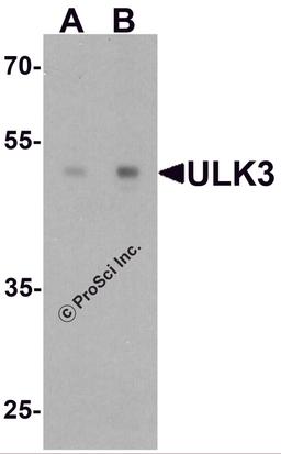 Western blot analysis of ULK3 in human brain tissue lysate with ULK3 antibody at (A) 0.5 and (B) 1 μg/ml.