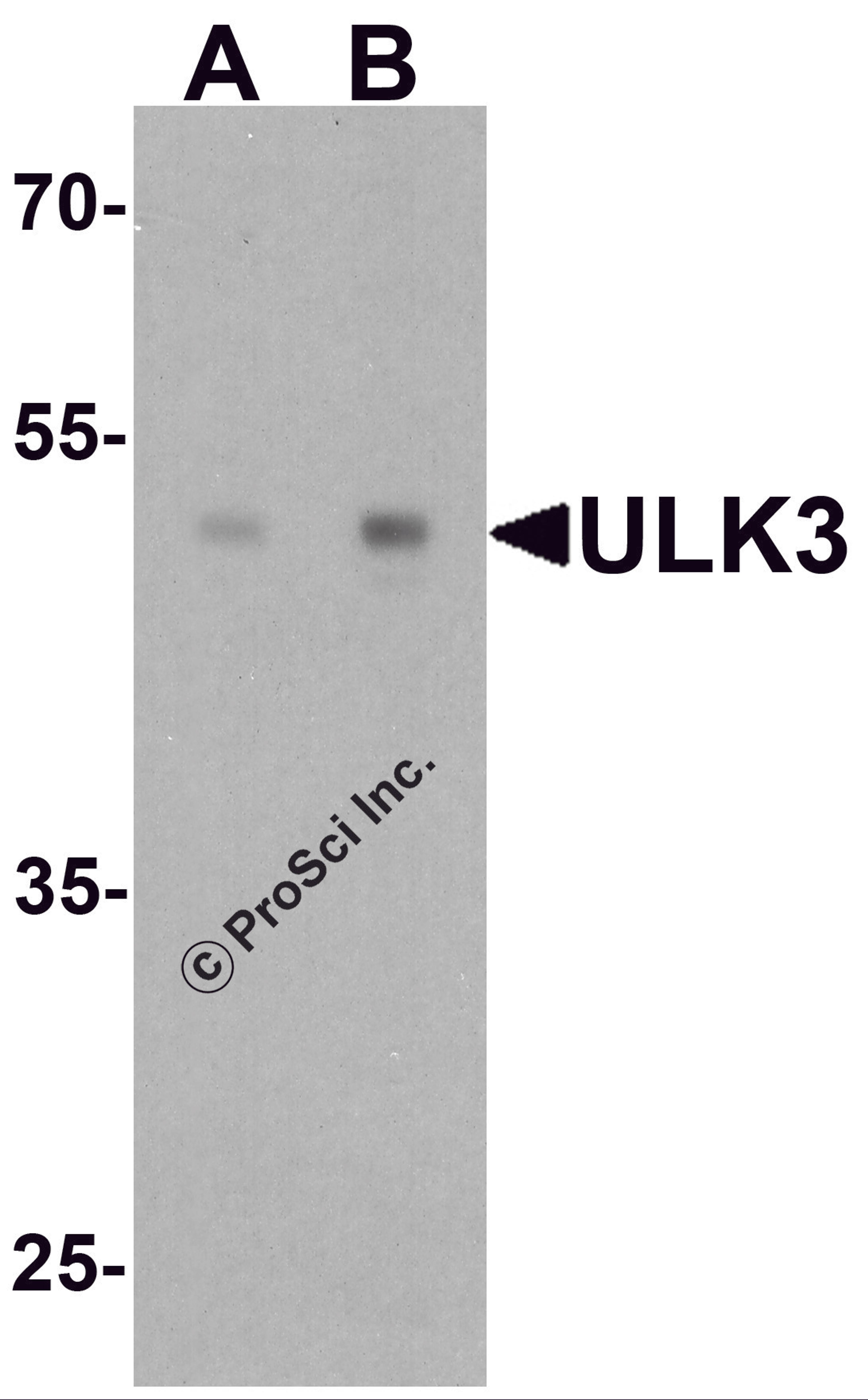Western blot analysis of ULK3 in human brain tissue lysate with ULK3 antibody at (A) 0.5 and (B) 1 μg/ml.
