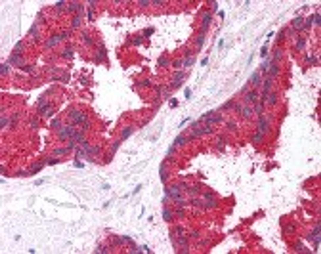 Immunohistochemistry staining of MMP7 in prostate tissue using MMP7 Antibody.