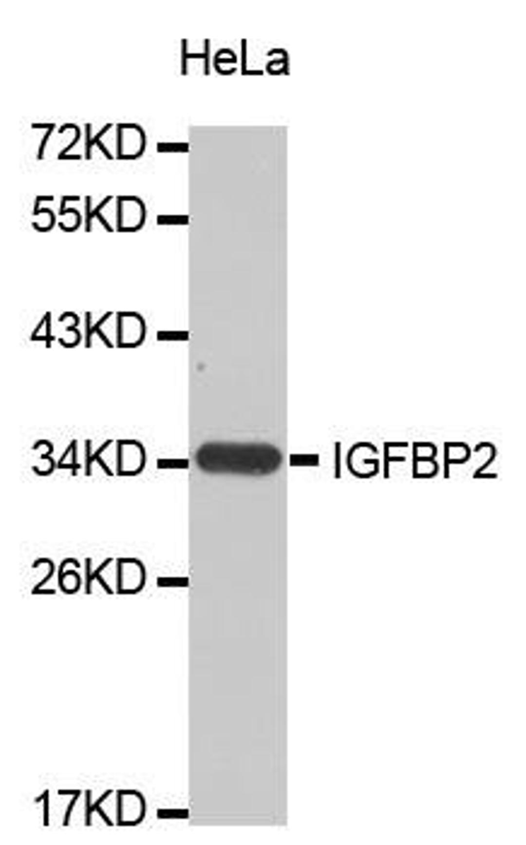 Western blot analysis of extracts of HeLa cell line using IGFBP-2 antibody