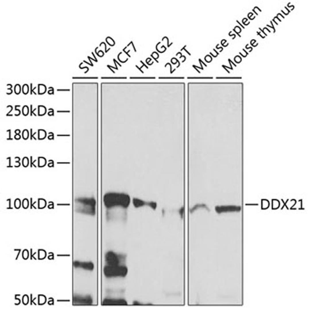 Western blot - DDX21 antibody (A7034)