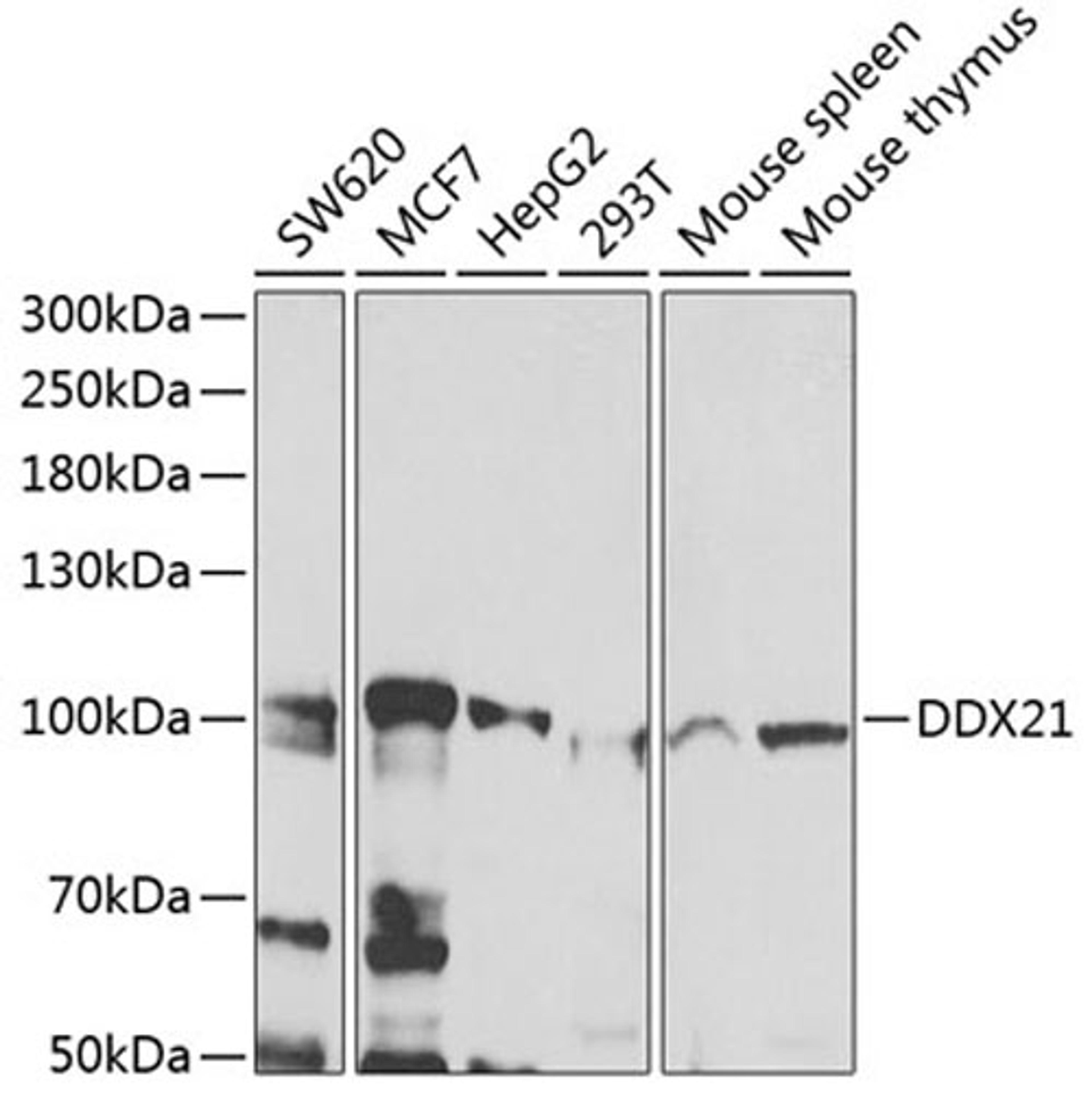 Western blot - DDX21 antibody (A7034)