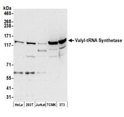 Detection of human and mouse Valyl-tRNA Synthetase/VARS by western blot.