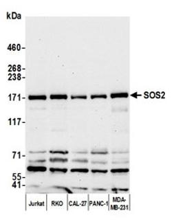 Detection of human SOS2 by western blot.