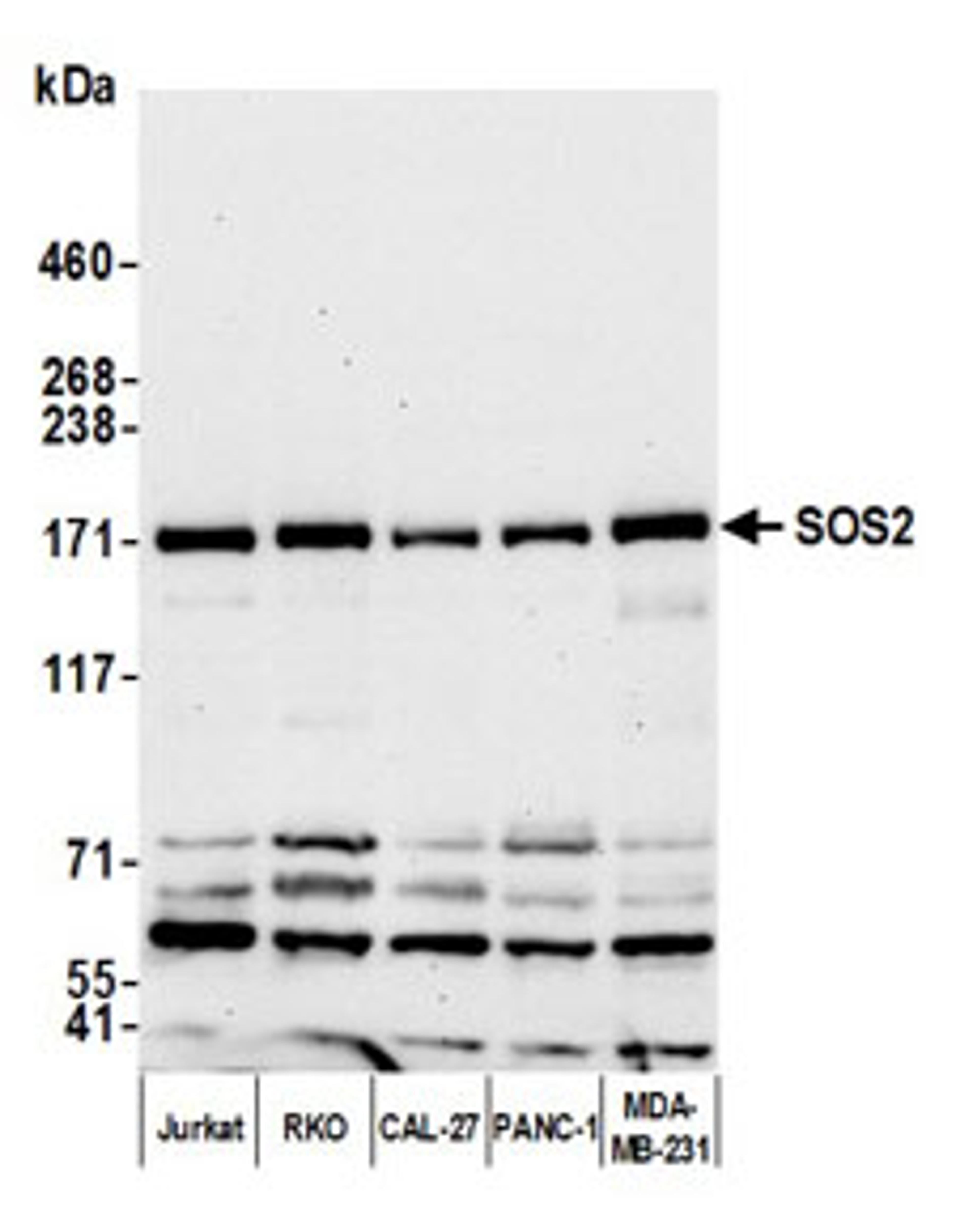 Detection of human SOS2 by western blot.