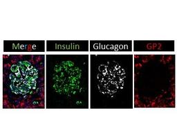 Immunofluorescence: GP2 Antibody [NBP1-86061] - Analysis of GP2 in frozen human pancreatic sections using anti-GP2 antibody. GP2 stains primarily exocrine tissue in human pancreas. Image from verified customer review.