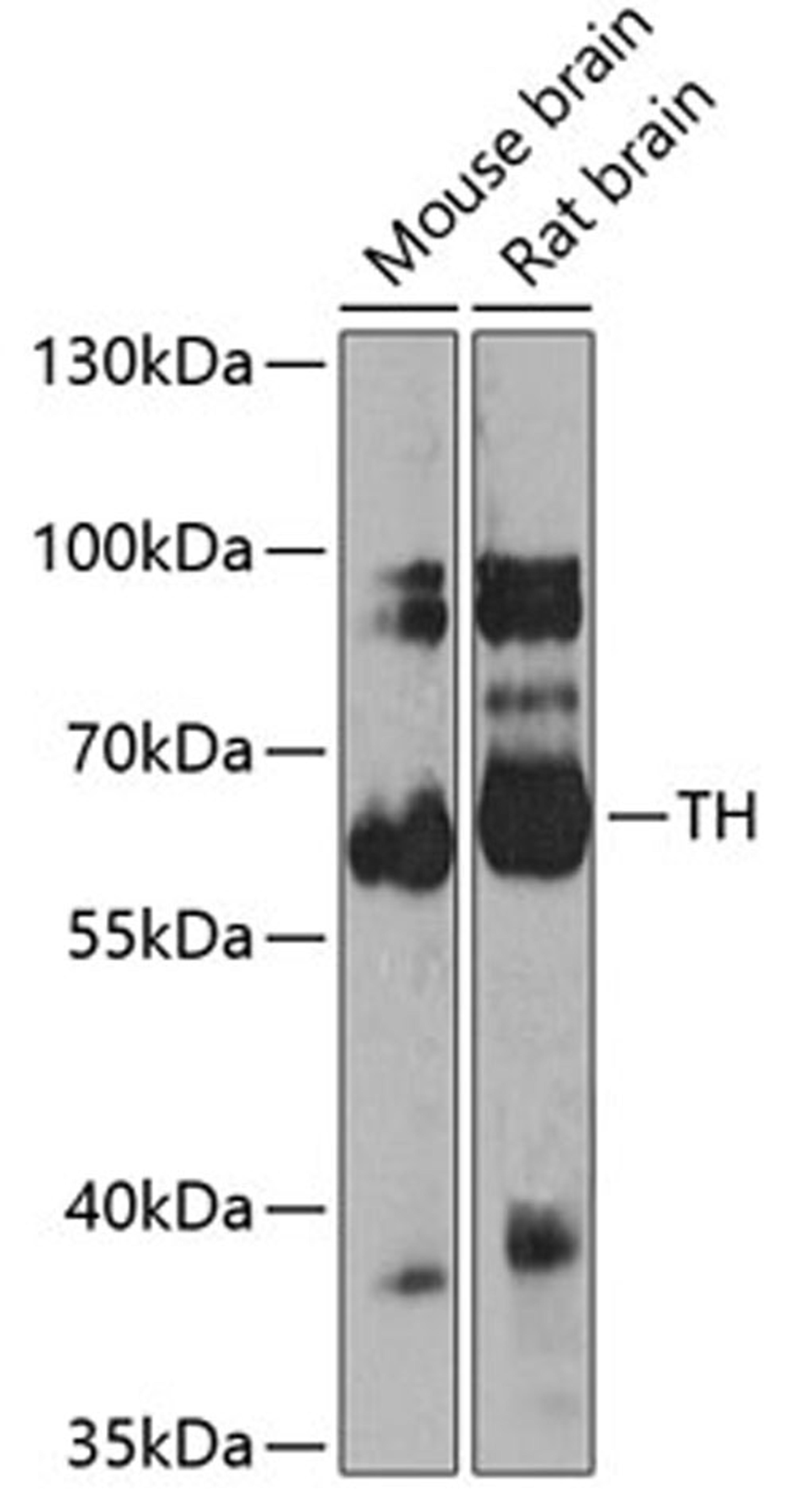 Western blot - TH antibody (A0028)