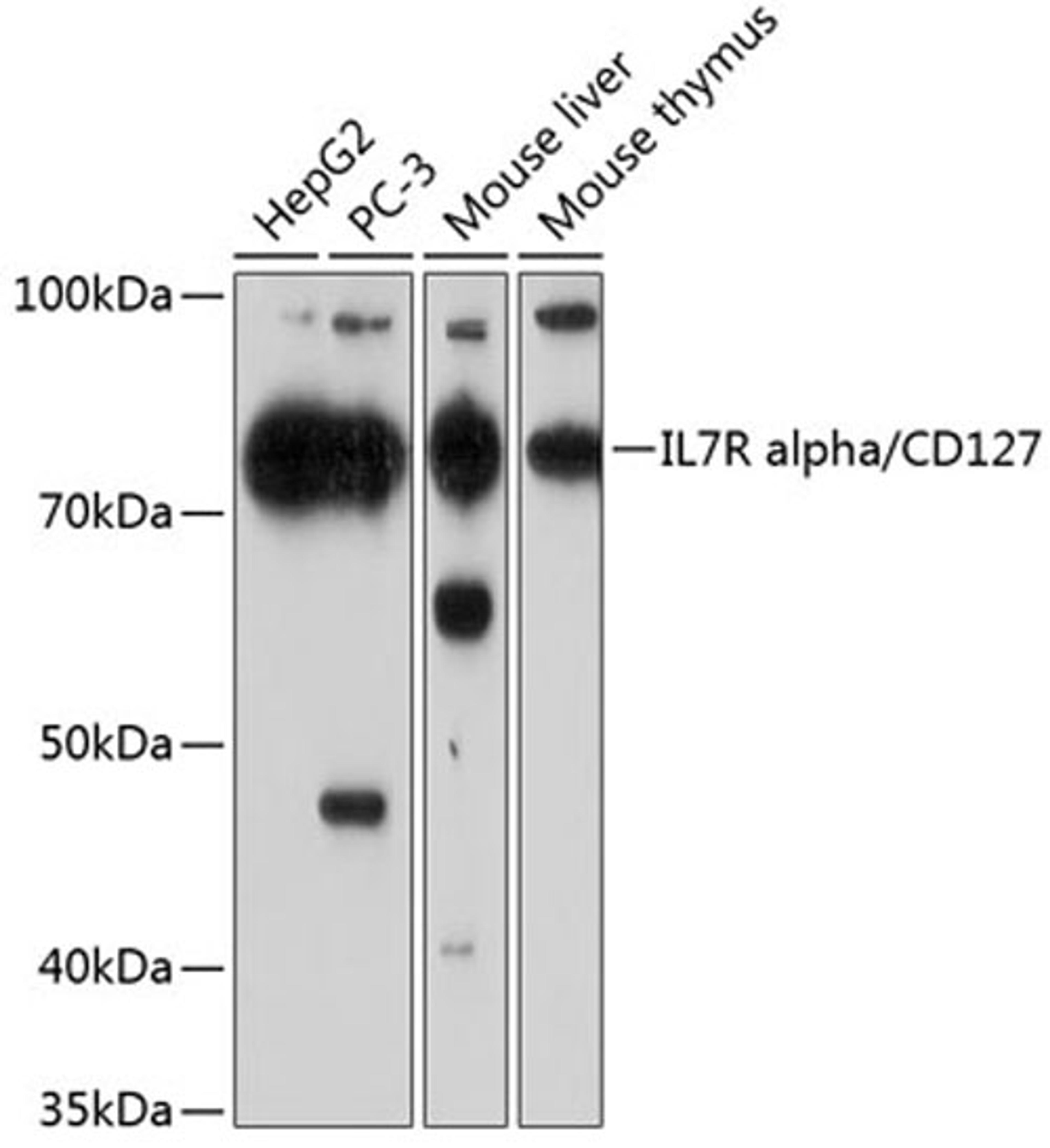 Western blot - IL7R alpha/CD127 Rabbit mAb (A11678)