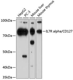 Western blot - IL7R alpha/CD127 Rabbit mAb (A11678)