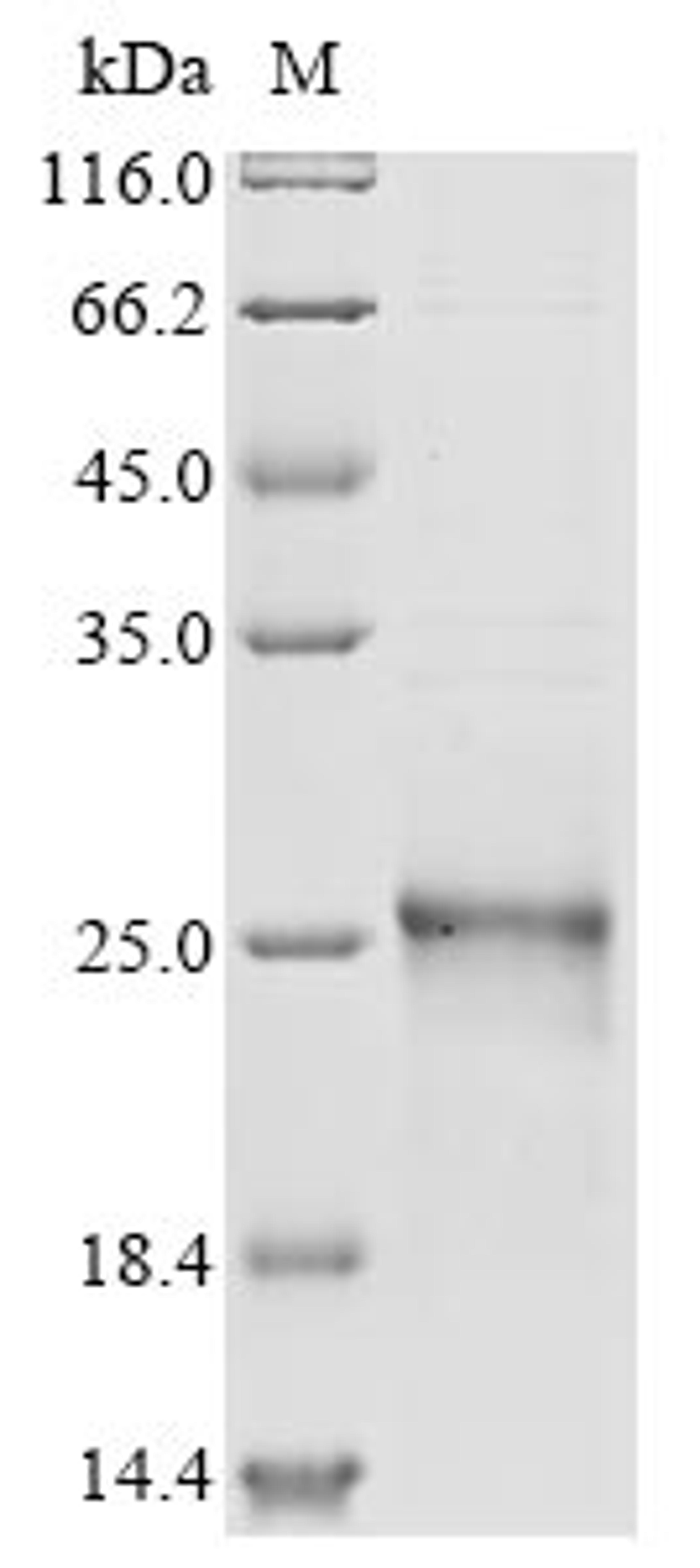 (Tris-Glycine gel) Discontinuous SDS-PAGE (reduced) with 5% enrichment gel and 15% separation gel.