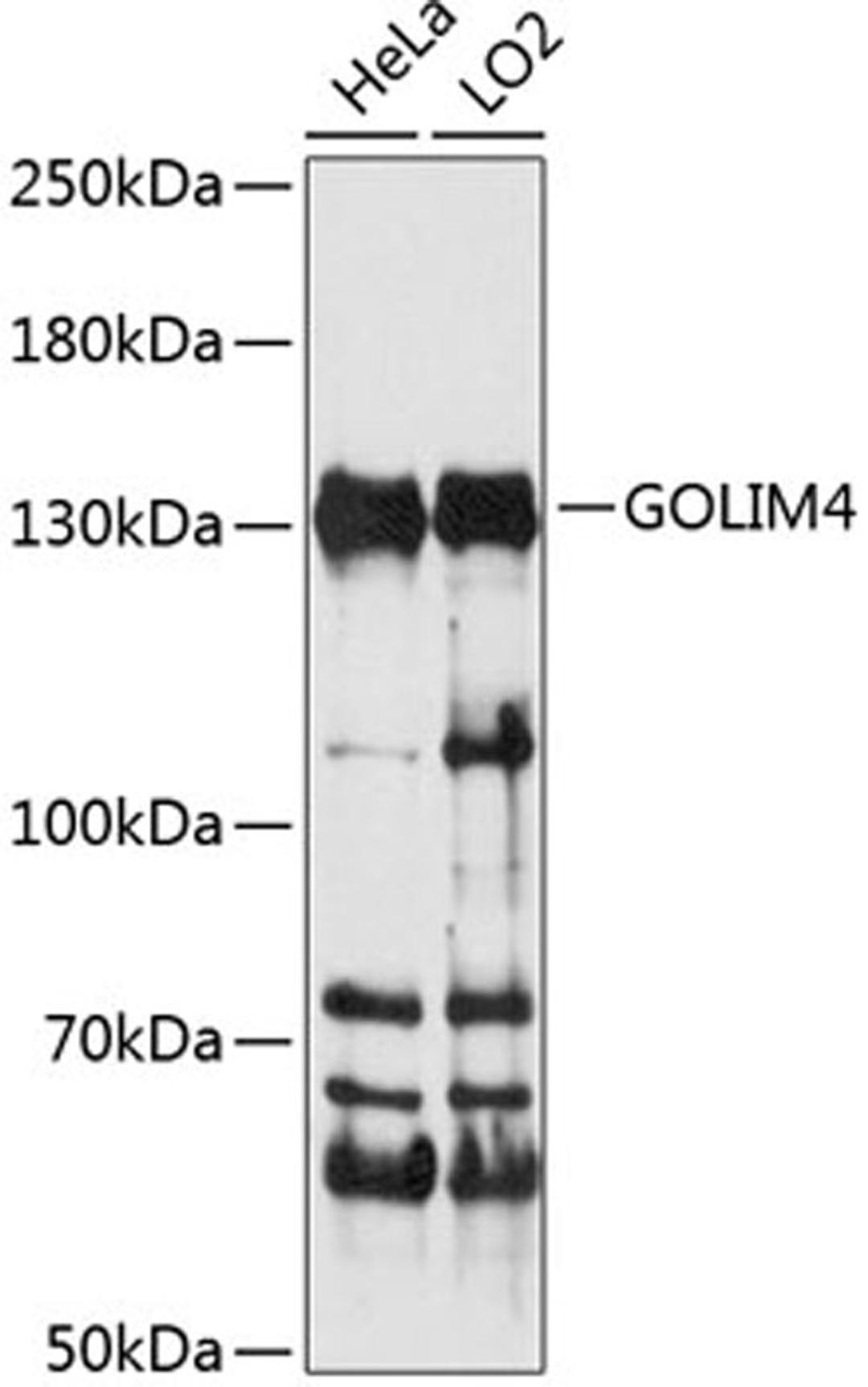 Western blot - GOLIM4 antibody (A14478)