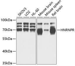 Western blot - HNRNPR antibody (A5883)