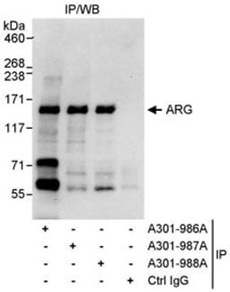 Detection of human ARG by western blot of immunoprecipitates.