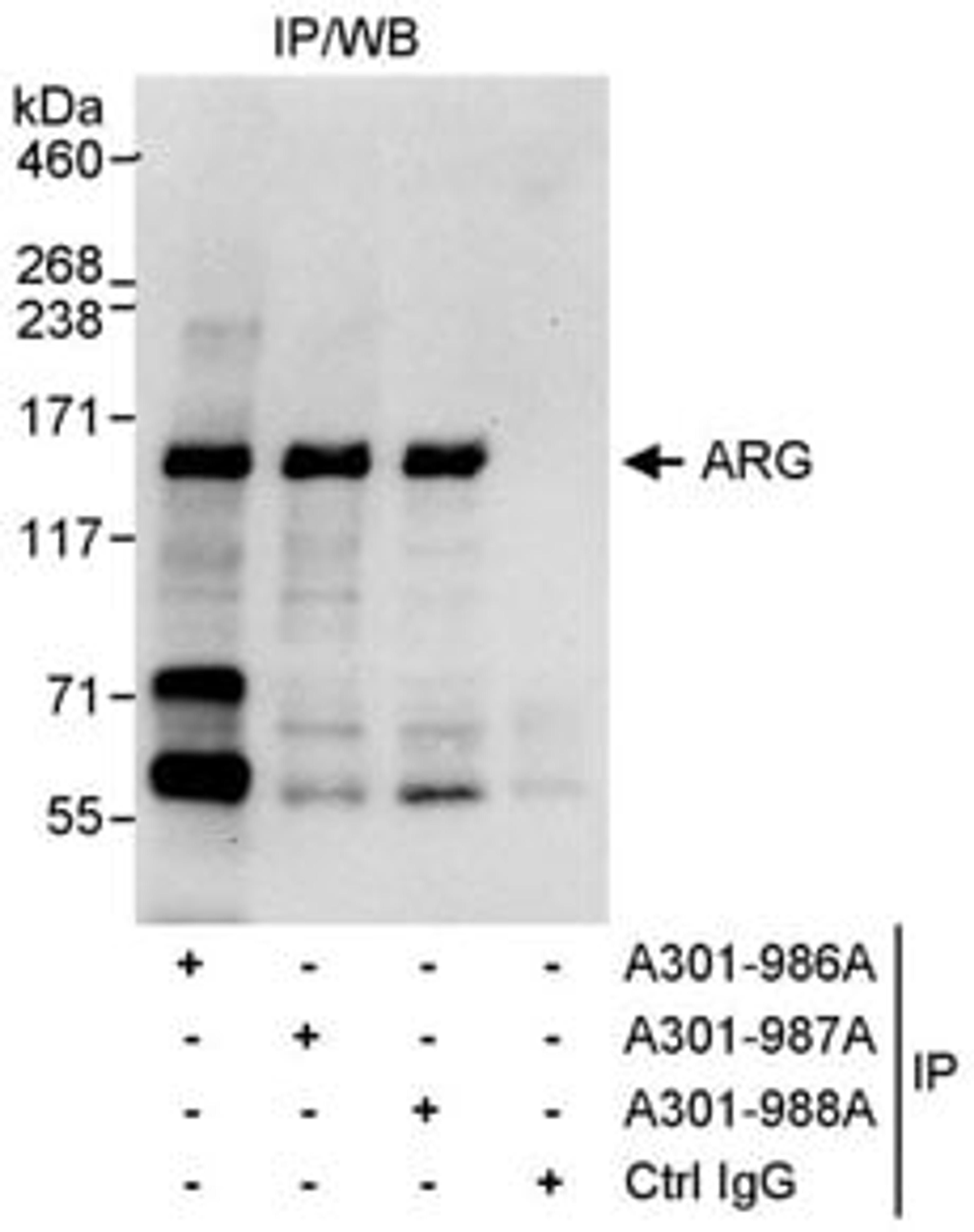 Detection of human ARG by western blot of immunoprecipitates.