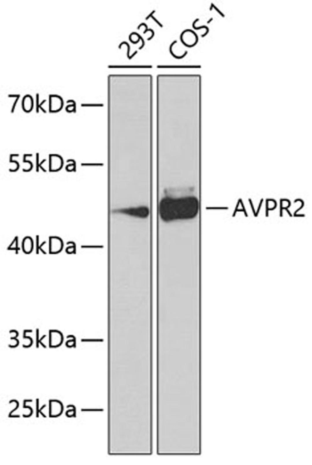 Western blot - AVPR2 Antibody (A7879)