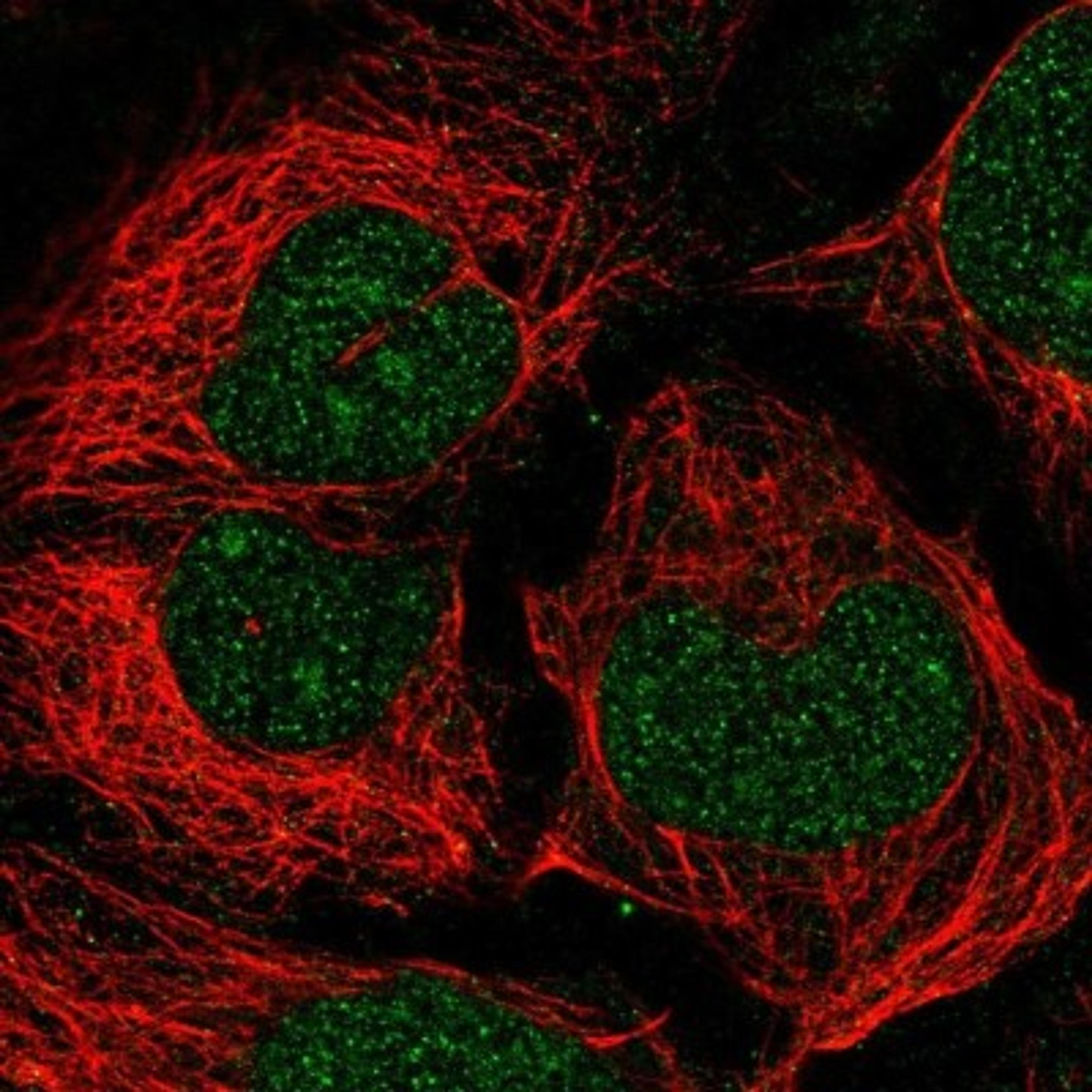 Immunocytochemistry/Immunofluorescence: EED Antibody [NBP2-38907] - Staining of human cell line CACO-2 shows positivity in nucleus and nucleoli.