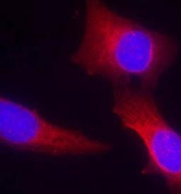 Confocal immunofluorescent analysis of human hippocampal region tissue using CaMKII(Ab-286) antibody