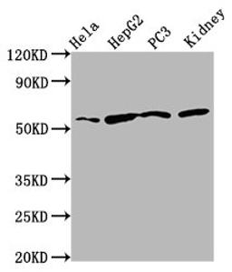 Western Blot. Positive WB detected in: Hela whole cell lysate, HepG2 whole cell lysate, PC-3 whole cell lysate, Rat kidney tissue. All lanes: TTI2 antibody at 8.7µg/ml. Secondary. Goat polyclonal to rabbit IgG at 1/50000 dilution. Predicted band size: 57 kDa. Observed band size: 57 kDa
