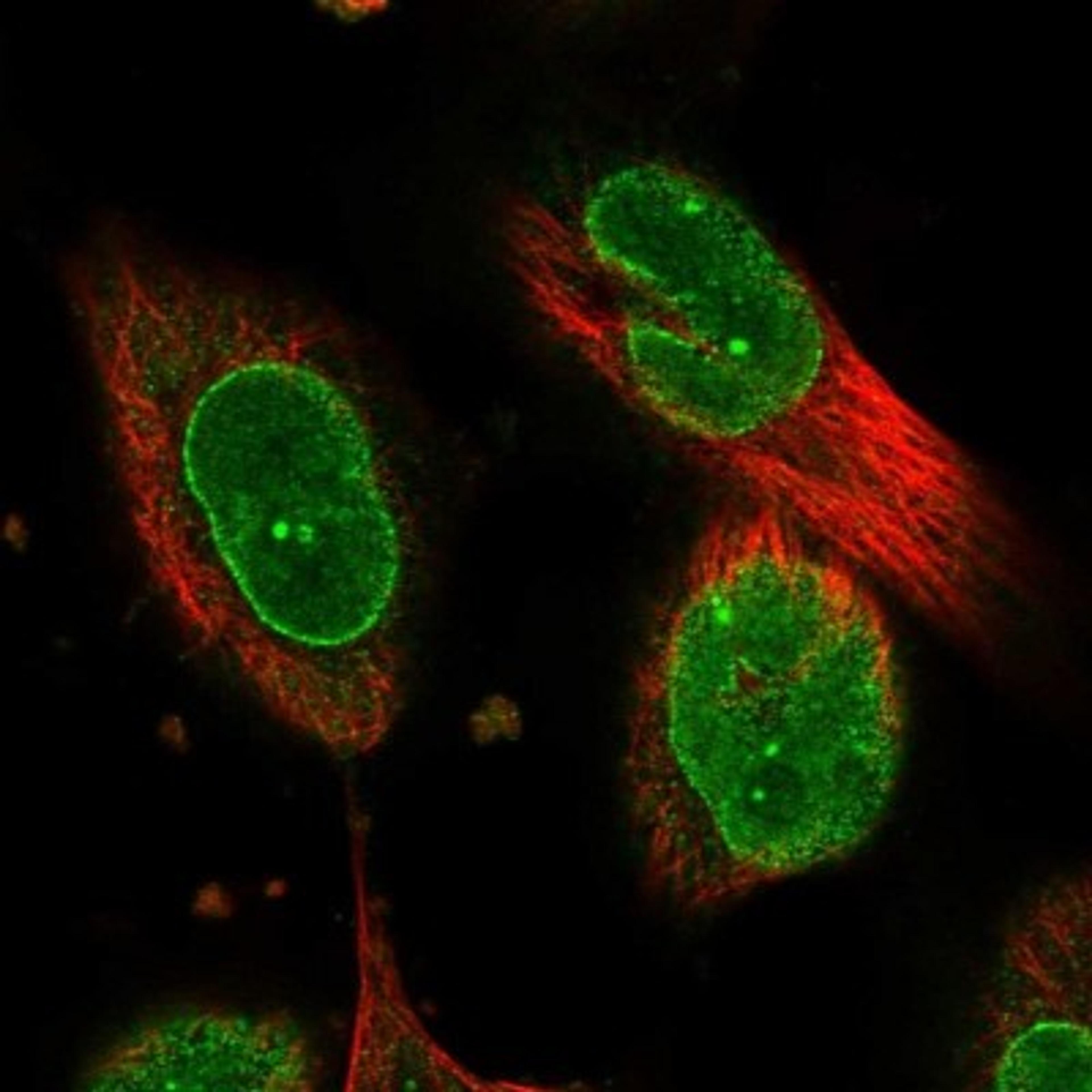 Immunocytochemistry/Immunofluorescence: CCDC34 Antibody [NBP1-93558] - Staining of human cell line U-251 MG shows positivity in nucleus, nucleoli & nuclear membrane.