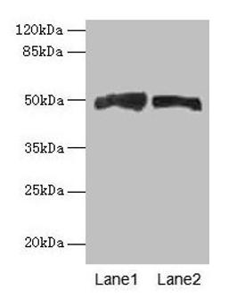 Western blot. All lanes: AZIN1 antibody at 4µg/ml. Lane 1: Mouse liver tissue. Lane 2: PC-3 whole cell lysate. Secondary. Goat polyclonal to rabbit IgG at 1/10000 dilution. Predicted band size: 50 kDa. Observed band size: 50 kDa