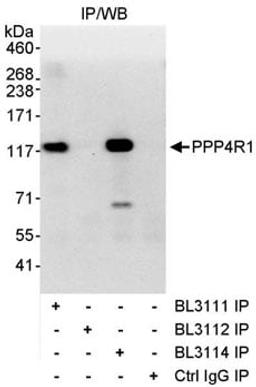 Detection of human PPP4R1 by western blot of immunoprecipitates.