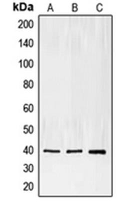 Western blot analysis of Jurkat (Lane 1), Raji (Lane 2), A431 (Lane 3) whole cell lysates using ECI2 antibody