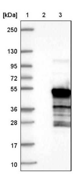 Western Blot: HEXIM2 Antibody [NBP1-93877] - Lane 1: Marker [kDa] 250, 130, 95, 72, 55, 36, 28, 17, 10<br/>Lane 2: Negative control (vector only transfected HEK293T lysate)<br/>Lane 3: Over-expression lysate (Co-expressed with a C-terminal myc-DDK tag (~3.1 kDa) in mammalian HEK293T cells, LY403395)