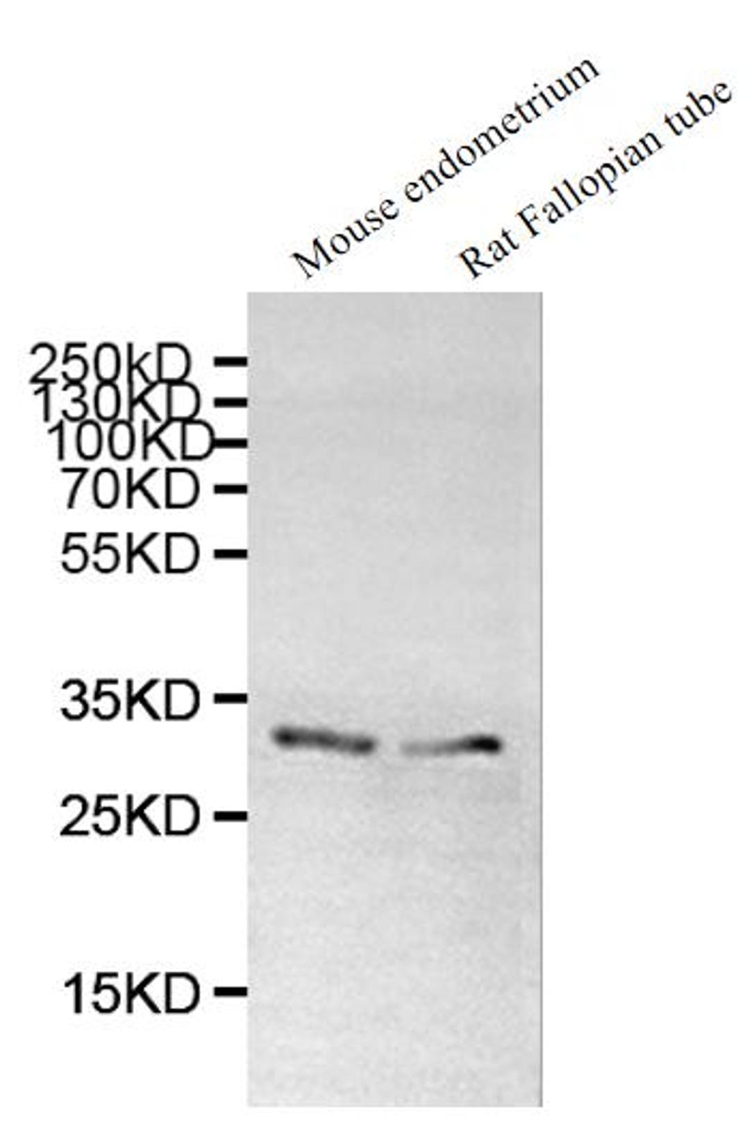 Western blot. All lanes: DNALI1 antibody at 1µg/ml. Lane 1: Mouse gonadal tissue. Lane 2: Mouse lung tissue. Secondary. Goat polyclonal to rabbit IgG at 1/10000 dilution. Predicted band size: 30, 16 kDa. Observed band size: 30 kDa