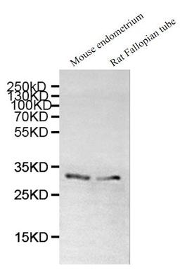 Western blot. All lanes: DNALI1 antibody at 1µg/ml. Lane 1: Mouse gonadal tissue. Lane 2: Mouse lung tissue. Secondary. Goat polyclonal to rabbit IgG at 1/10000 dilution. Predicted band size: 30, 16 kDa. Observed band size: 30 kDa