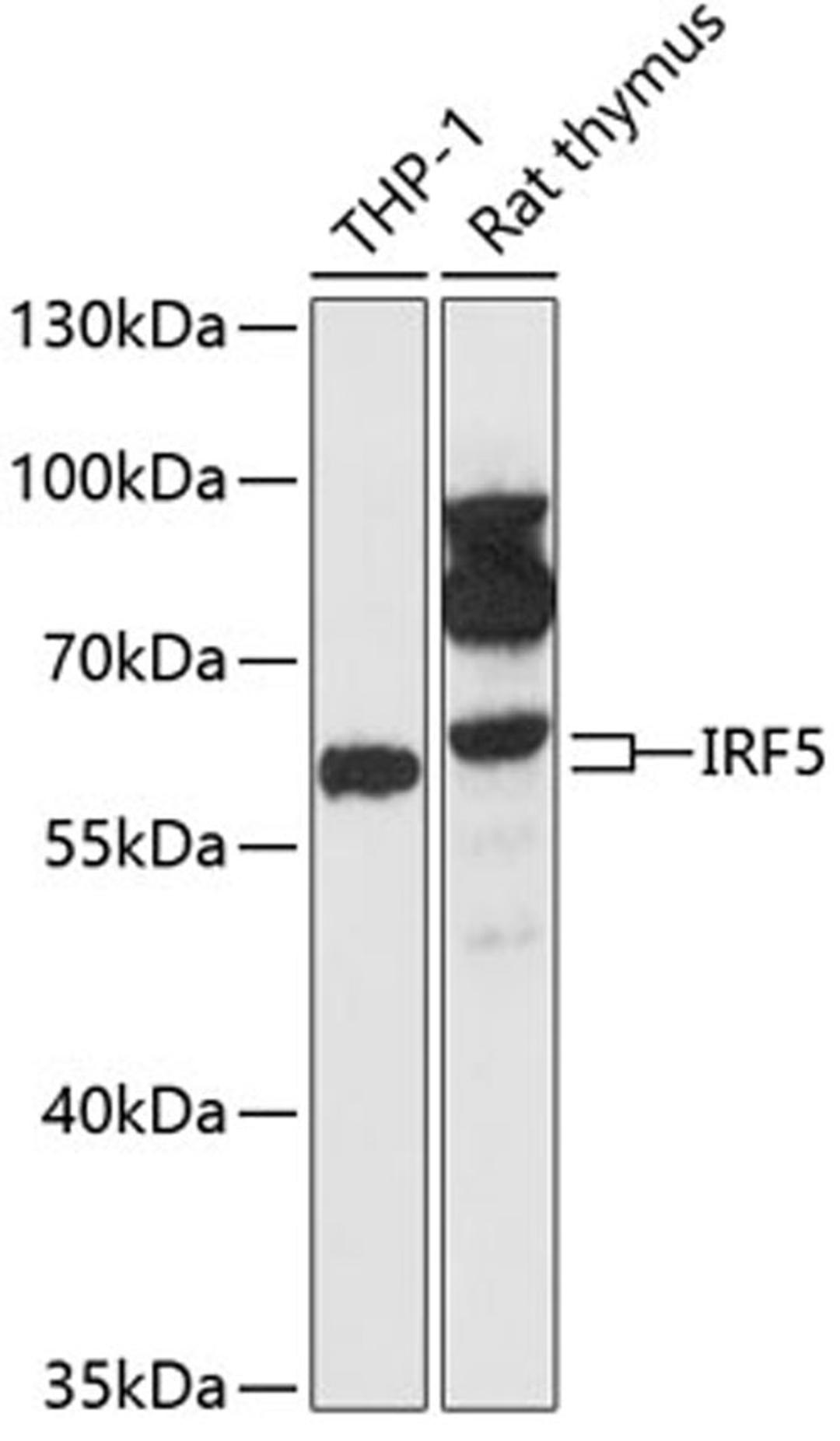 Western blot - IRF5 antibody (A13621)