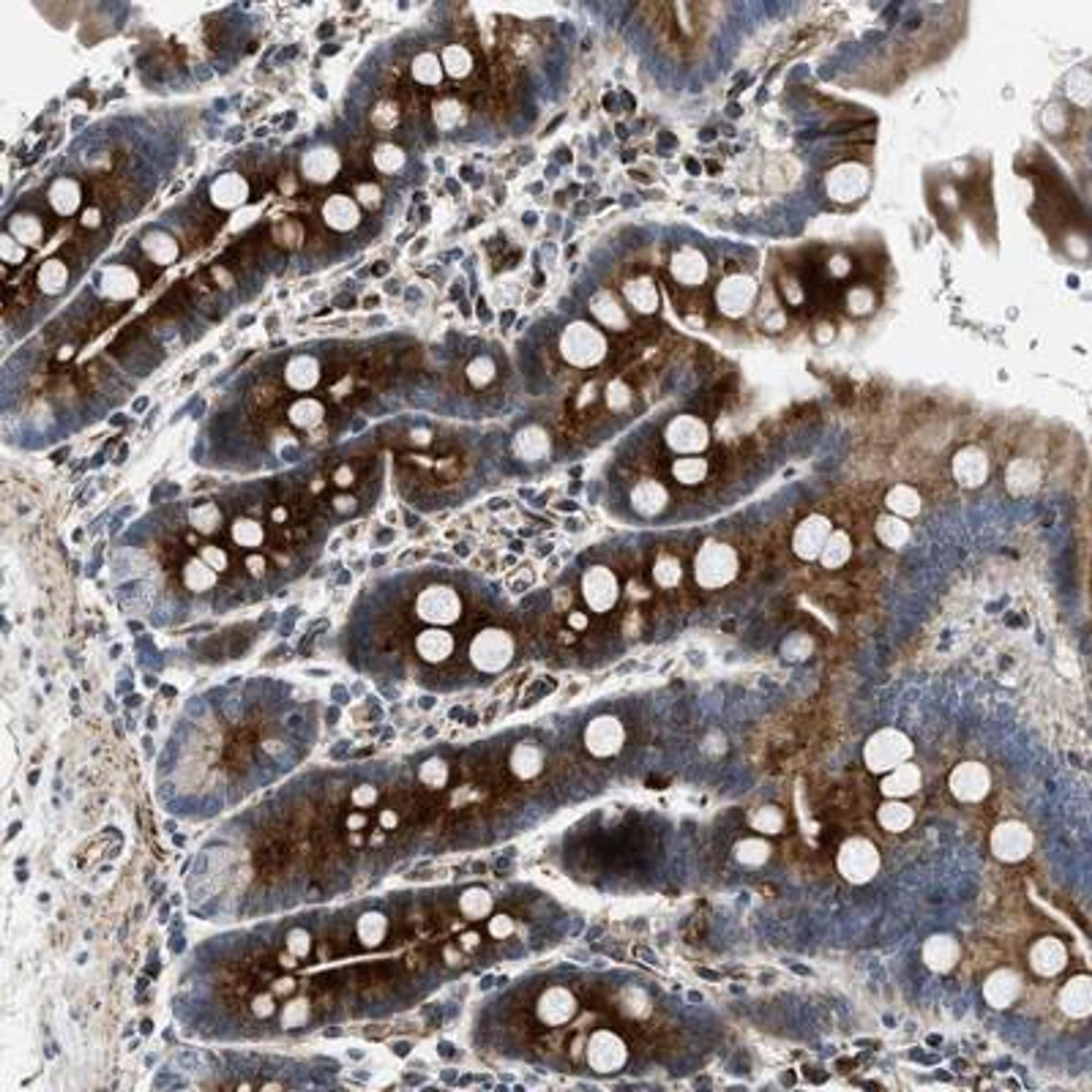 Immunohistochemistry-Paraffin: IL-17 RC Antibody [NBP1-83112] -  Immunohistochemical staining of human duodenum shows strong cytoplasmic positivity in glandular cells.