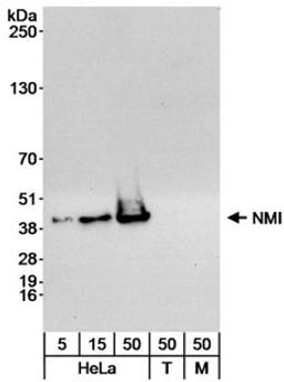 Detection of human NMI by western blot.