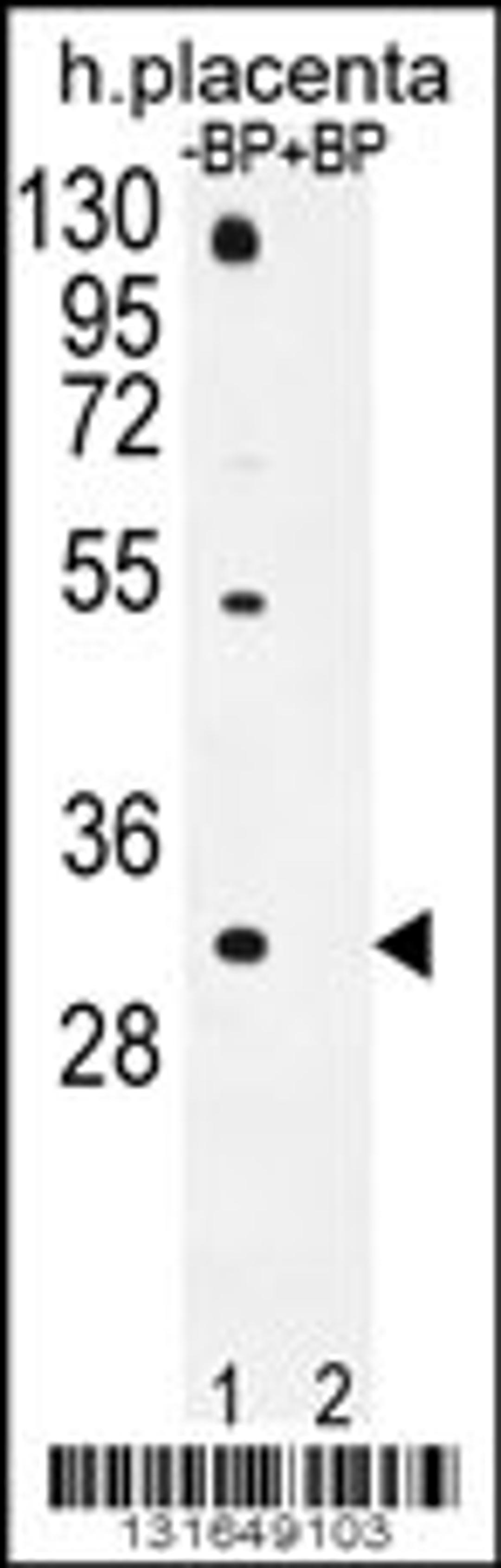 Western blot analysis of OR1D5 Antibody Pab pre-incubated without(lane 1) and with(lane 2) blocking peptide in human placenta tissue lysate.