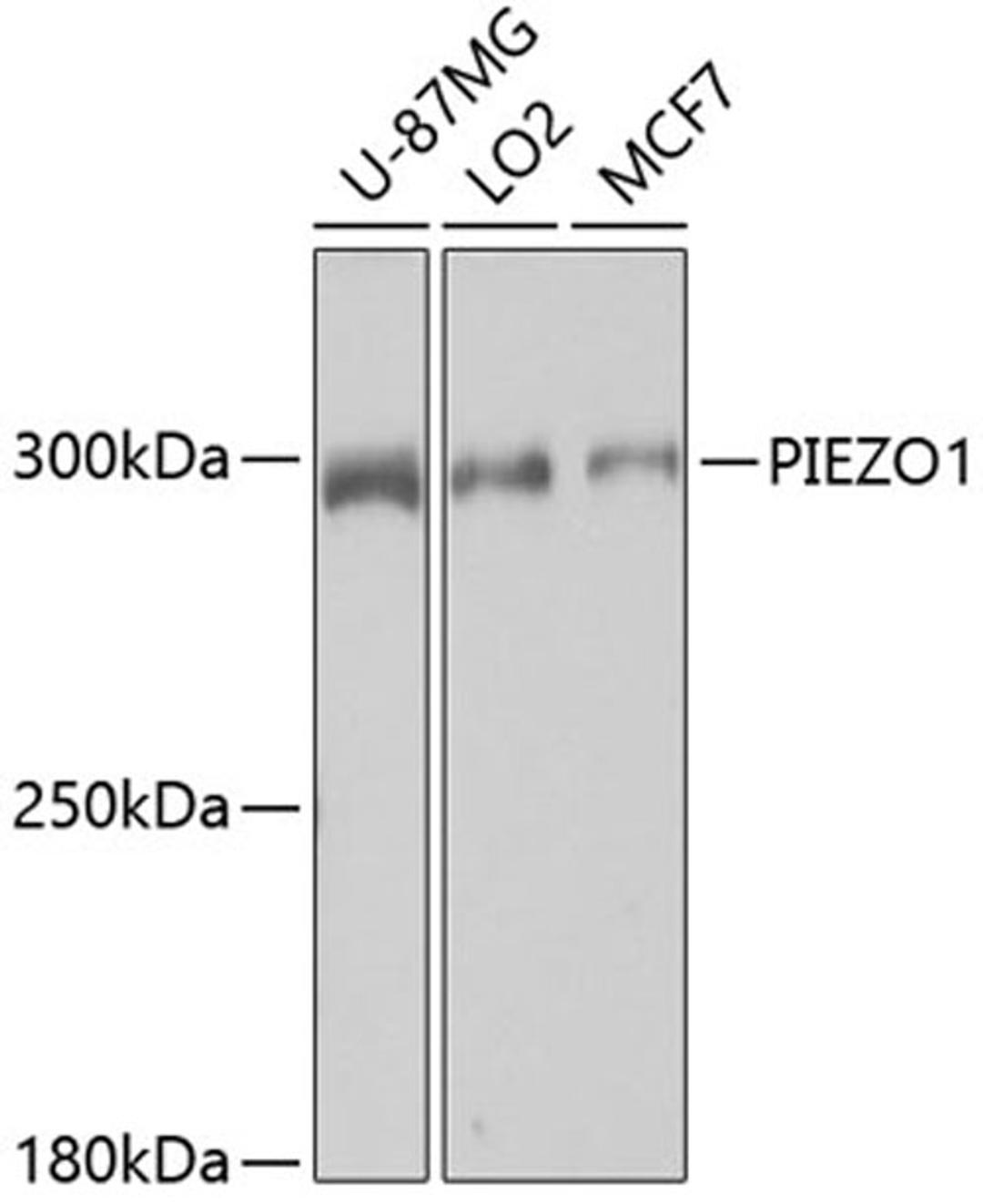 Western blot - PIEZO1 antibody (A4340)