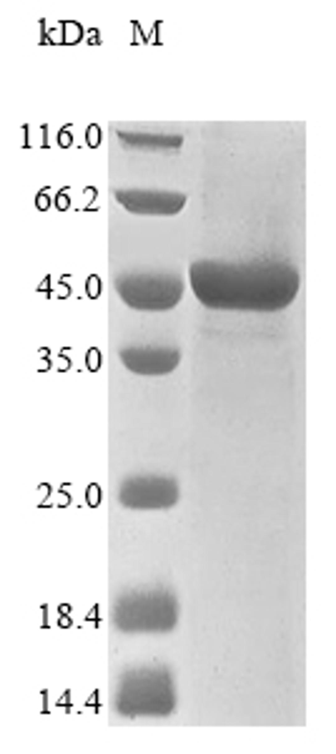 (Tris-Glycine gel) Discontinuous SDS-PAGE (reduced) with 5% enrichment gel and 15% separation gel.