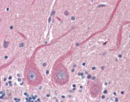 Immunohistochemistry-Paraffin: Sec8 Antibody (14G1) [NBP1-97492] - Analysis of human brain, cerebellum tissue stained with rSec8, mAb (14G1) at 5ug/ml.