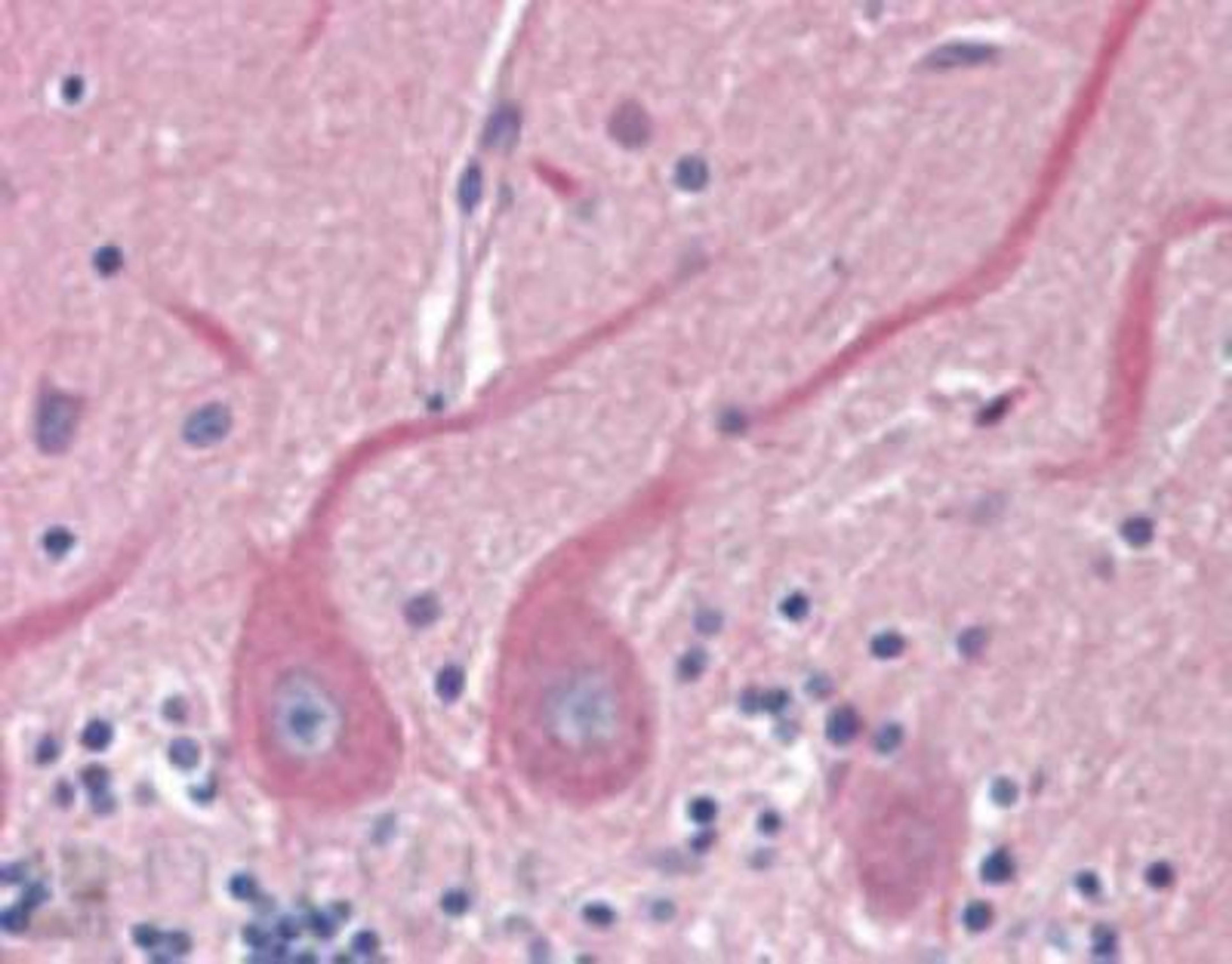 Immunohistochemistry-Paraffin: Sec8 Antibody (14G1) [NBP1-97492] - Analysis of human brain, cerebellum tissue stained with rSec8, mAb (14G1) at 5ug/ml.