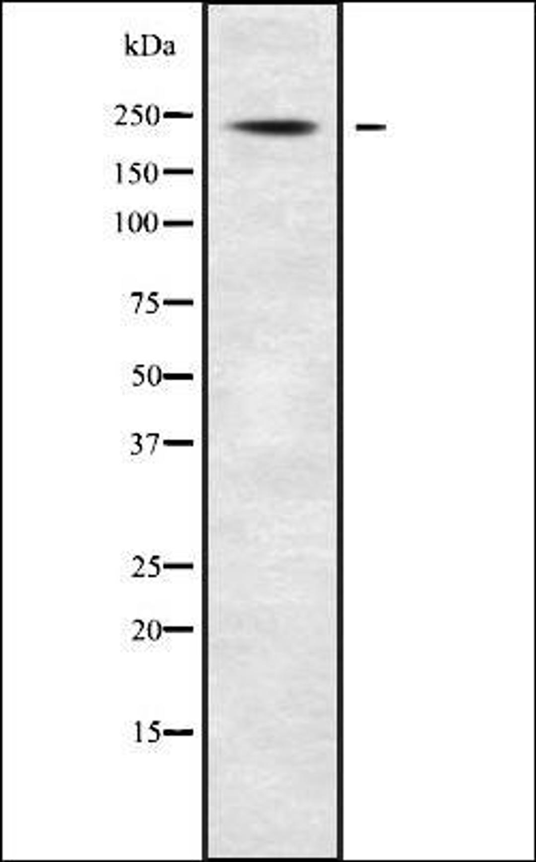 Western blot analysis of Jurkat whole cell lysates using ABCA7 antibody