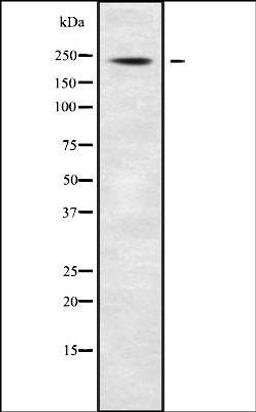 Western blot analysis of Jurkat whole cell lysates using ABCA7 antibody